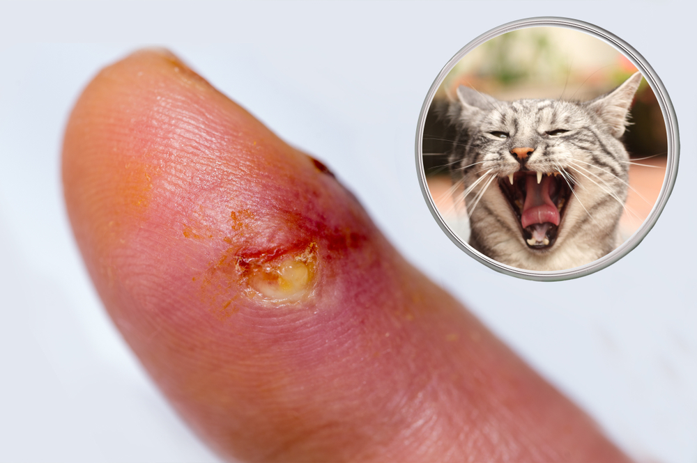 猫に噛まれた時に危険性がある感染症とその対処法 薬剤師が監修 運営する健康情報サイトnotice 株式会社infinite Evolution