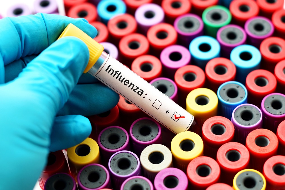 インフルエンザ、influenza、インフルエンザ予防、インフルエンザワクチン、インフルエンザ対策